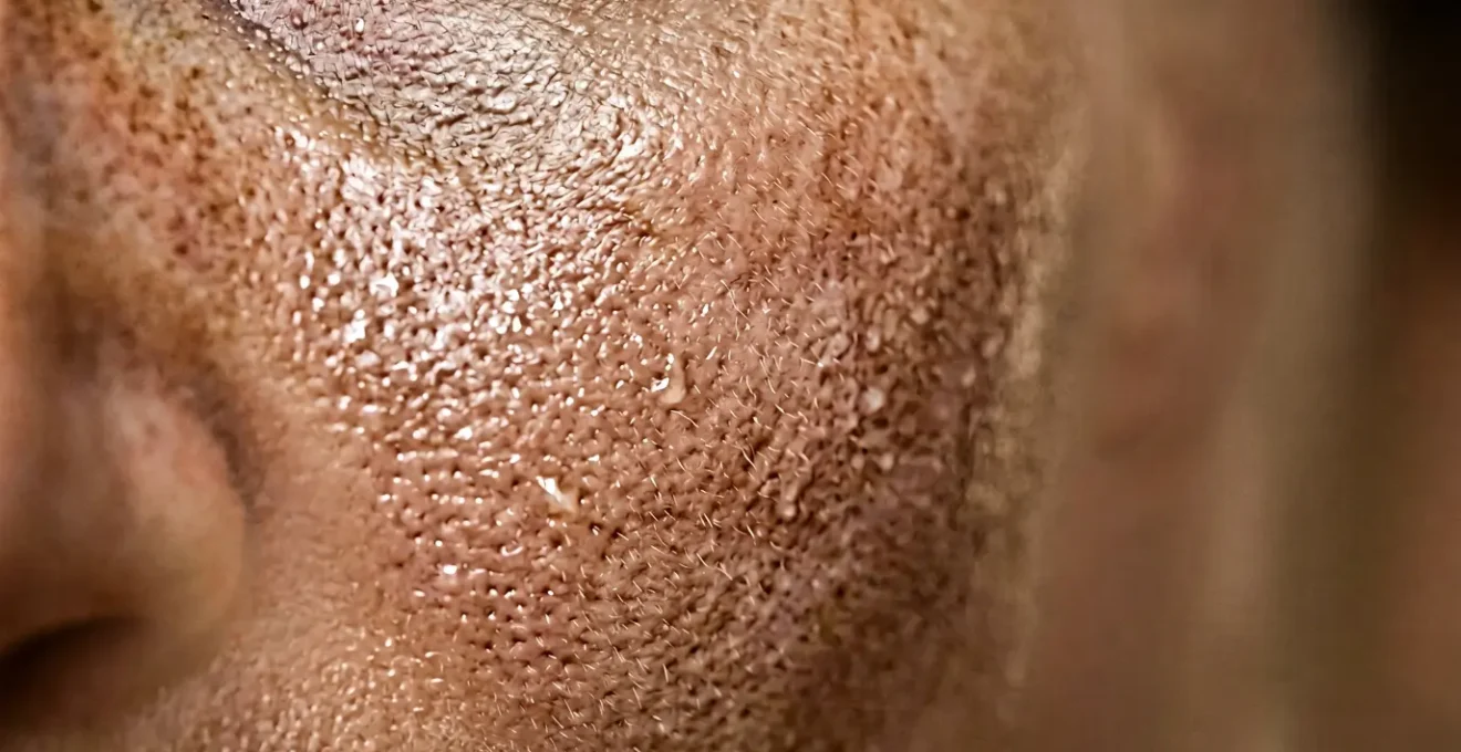 Trattamento di biorivitalizzazione su pelle del viso con idratazione profonda senza volume