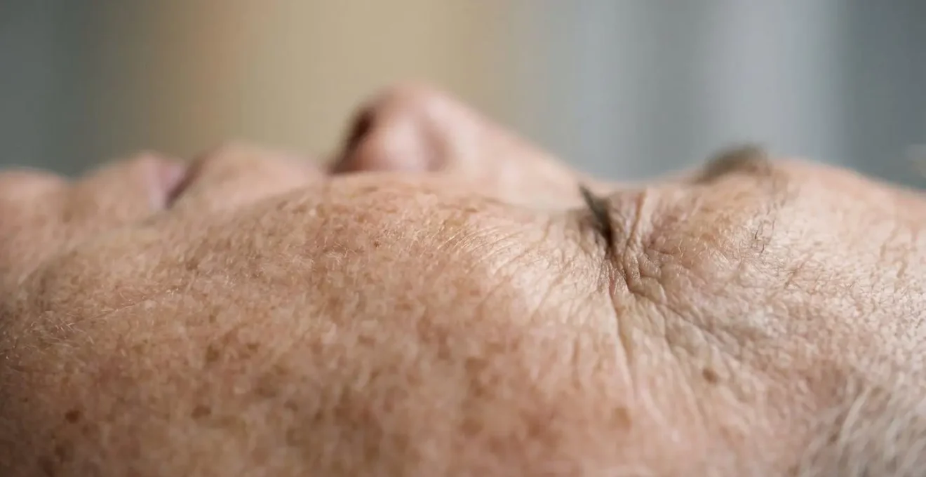 Dettaglio estremo di pelle matura con segni di fotoinvecchiamento, texture profonda che rivela il danneggiamento del collagene dermico