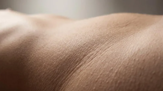Dettaglio anatomico della zona dei fianchi che mostra gli accumuli adiposi resistenti all'esercizio fisico