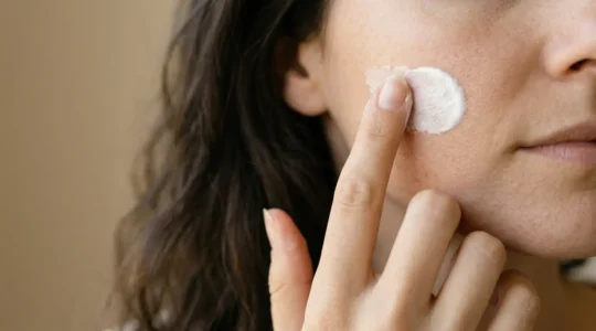 Protezione solare ad alto fattore dopo trattamenti estetici per prevenire iperpigmentazione