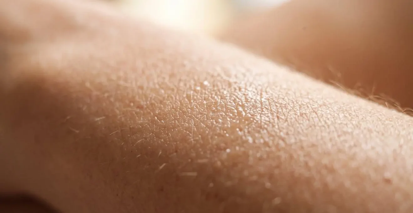 Rappresentazione visiva della differenza tra gonfiore normale e infiammatorio post-filler