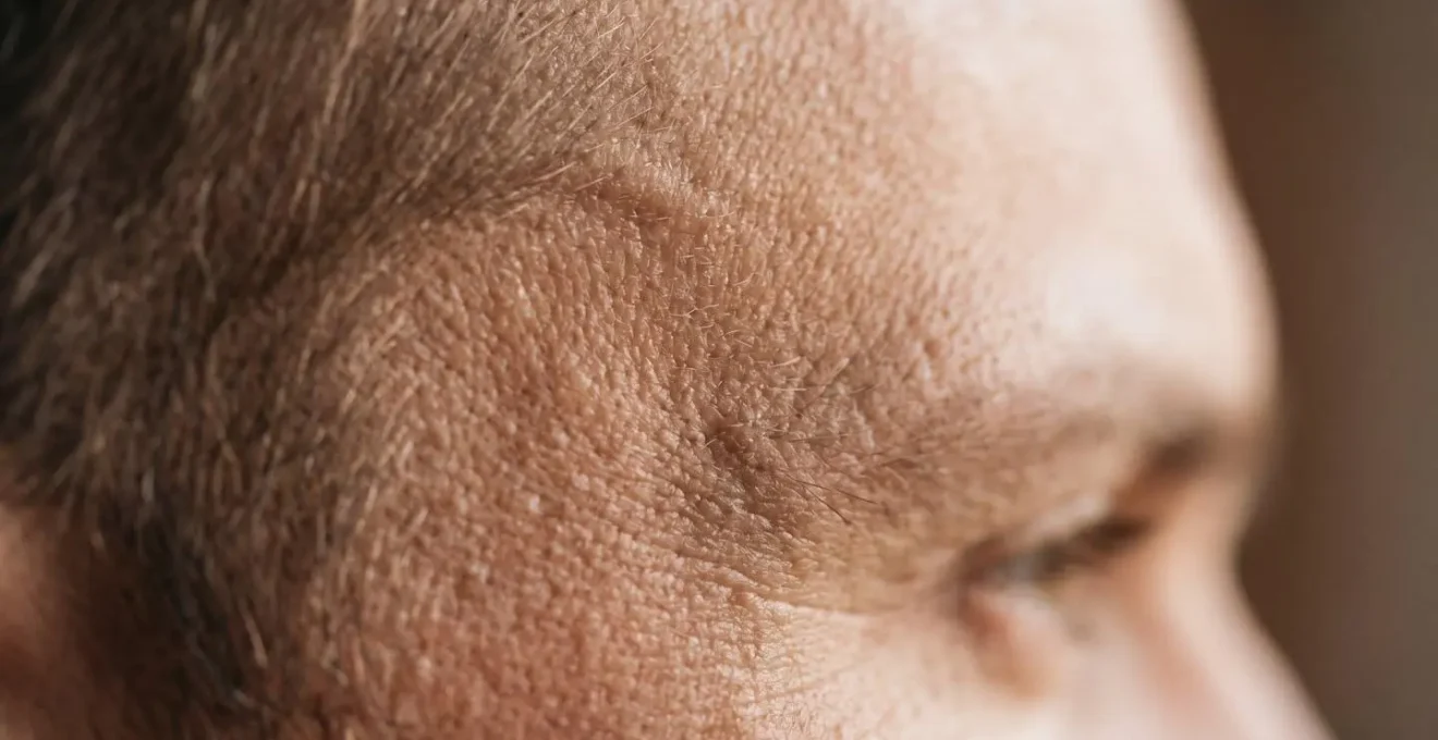 Rappresentazione visiva dell'anatomia del viso che mostra la perdita di volume nelle tempie
