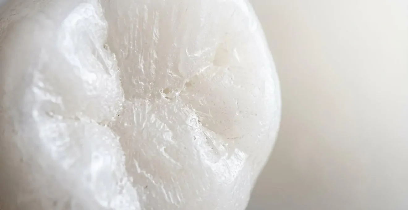 Dettaglio macro di superficie dentale con preparazione minimale per faccette estetiche